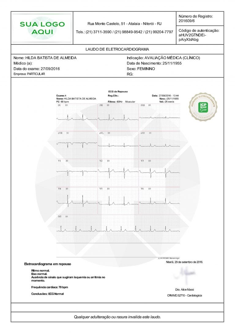 modelo de laudo médico ecg