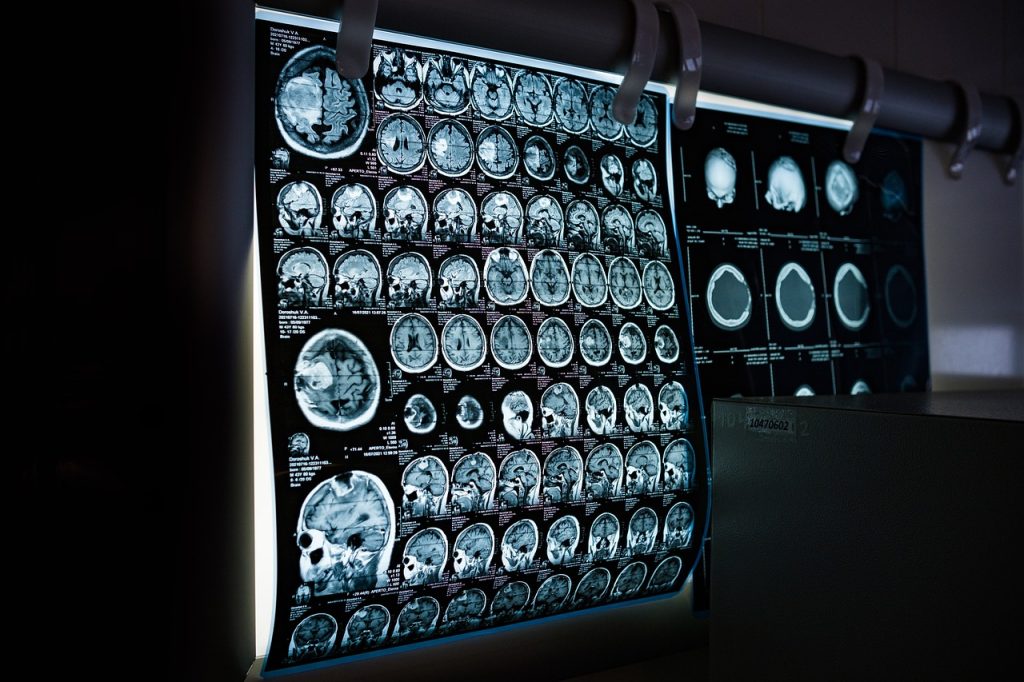 Exames na telemedicina